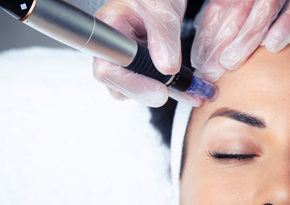 Microneedling Cost in Mumbai, India
