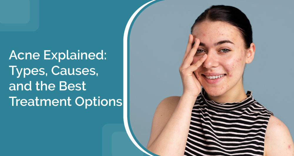 Acne treatment in Mumbai