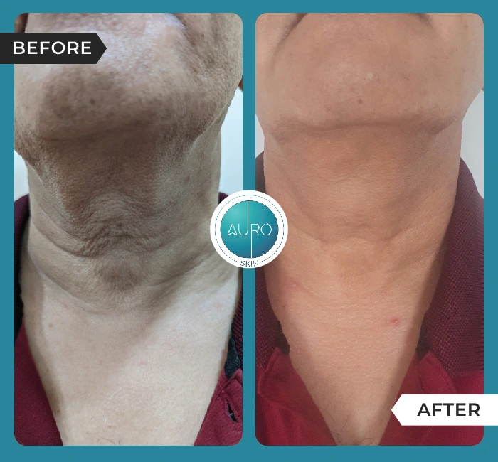 Home 34 Anti ageing treatment by Threads