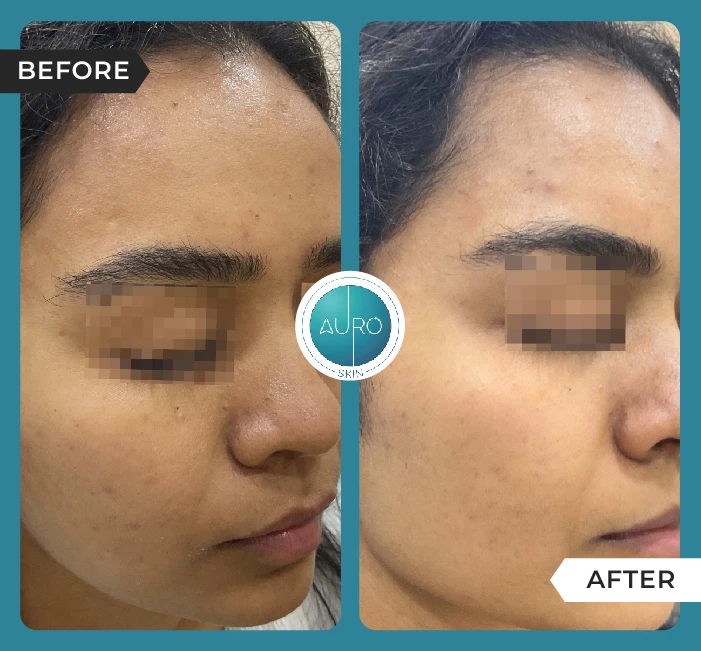 Before After Images