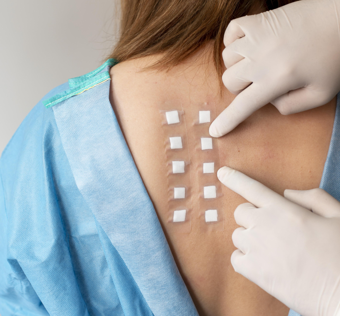 Benefits of Allergy Testing
