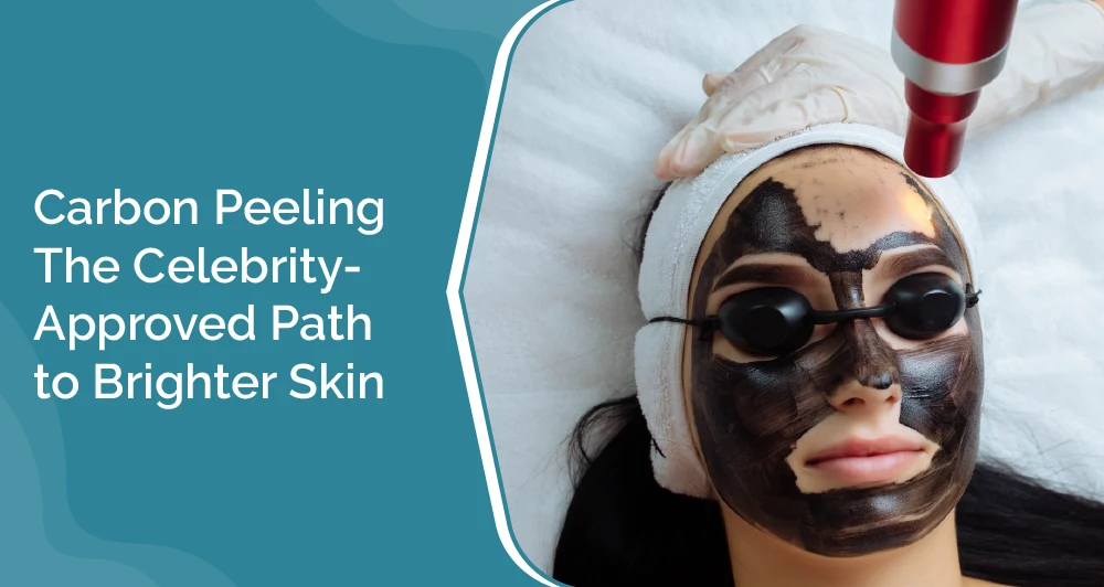 Carbon Peeling: The Celebrity-Approved Path to Brighter Skin 1 Hollywood laser peel