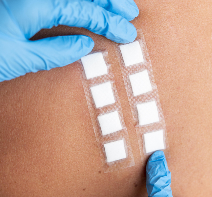 Choose Auro Skin Clinic For Allergy Testing