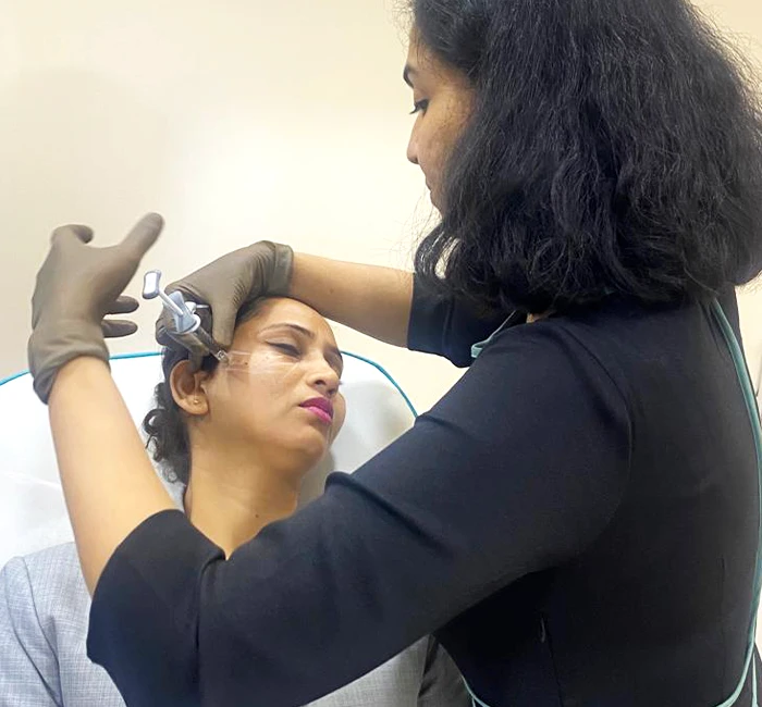 Derma Fillers