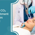 Fractional CO₂ Laser Treatment for Wrinkles and Scars: A Guide