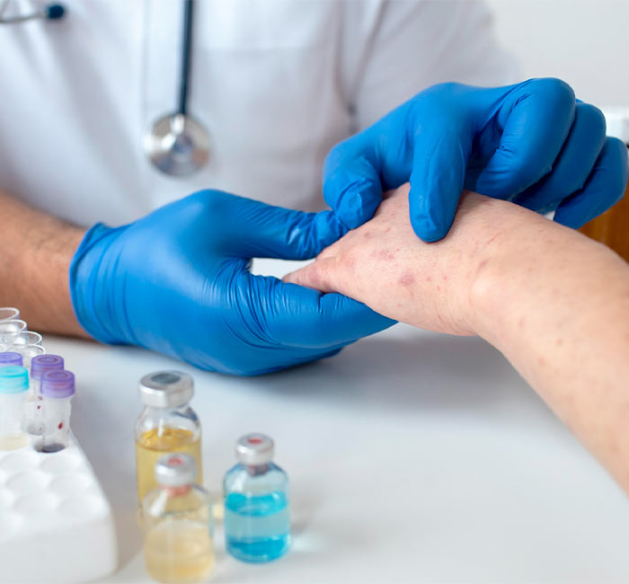 Fungal Infection Treatment Procedure