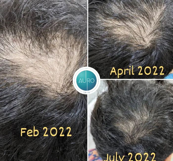 Hair Treatment Before & After