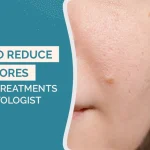 How to Reduce Open Pores: Causes, Treatments & Dermatologist Tips