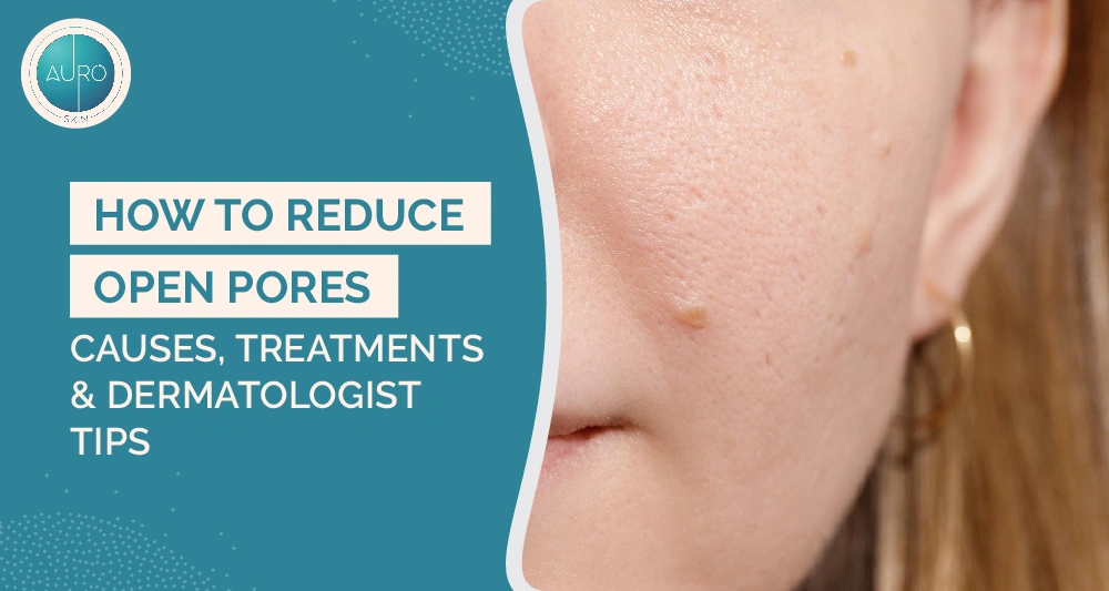 How to Reduce Open Pores: Causes, Treatments & Dermatologist Tips 1 How to Reduce Open Pores Causes Treatments Dermatologist Tips