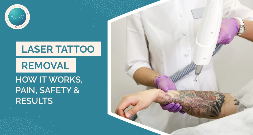 Laser Tattoo Removal: How It Works, Pain, Safety & Results 1 Laser Tattoo Removal How It Works Pain Safety Results
