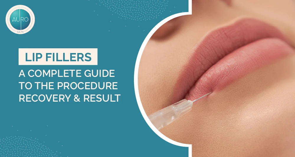 Lip Fillers: A Complete Guide to the Procedure, Recovery & Results 1 Lip Fillers A Complete Guide to the Procedure Recovery Results