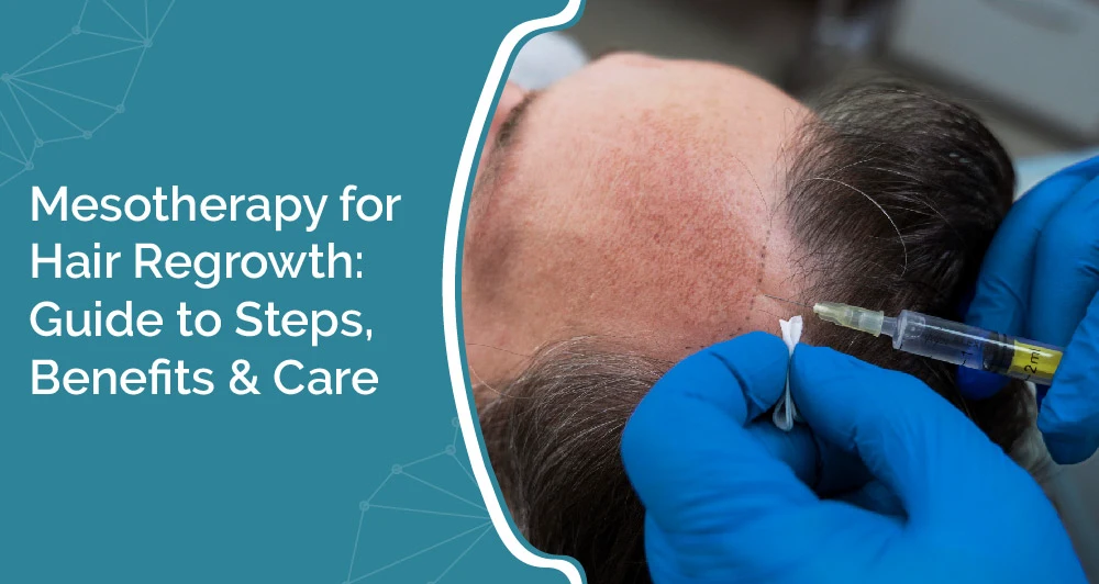 Mesotherapy for Hair Regrowth: Guide to Steps, Benefits & Care 1 Mesotherapy for hair regrowth