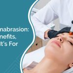 Microdermabrasion: Types, Benefits, and Who It’s For
