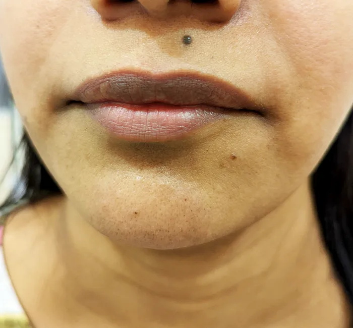 Mole
