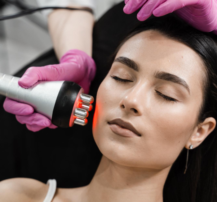 RF Skin Tightening Treatment 1