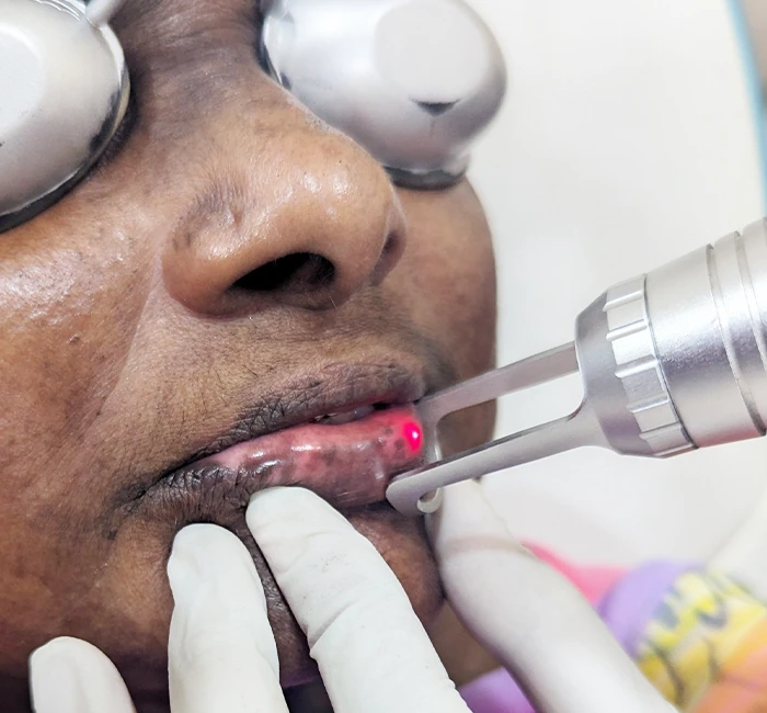 Skin Pigmentation