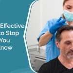 The Most Effective Methods to Stop Hair Loss You Need to Know