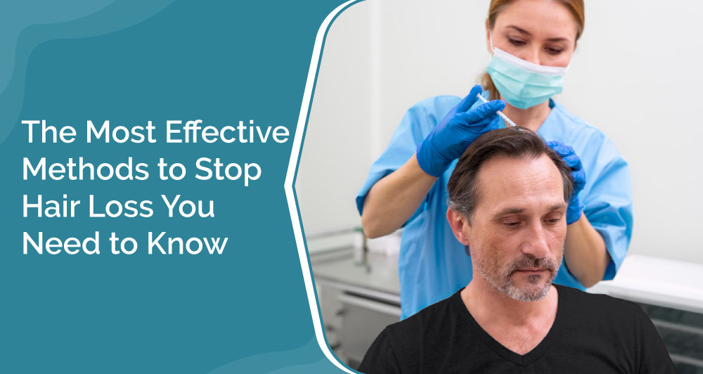 Effective Methods to Stop Hair Loss