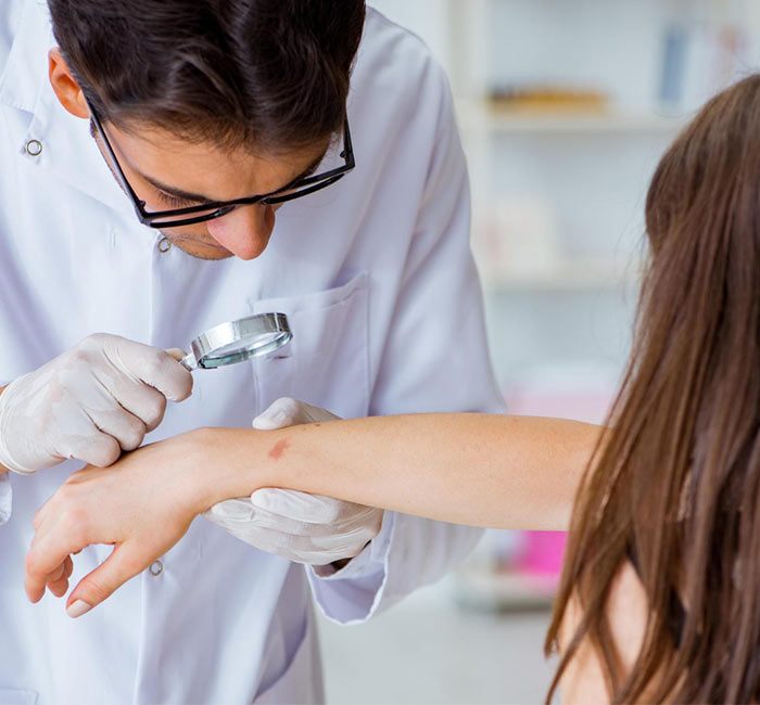 Why Choose Auro Skin Clinic For Urticaria Treatment in Mumbai
