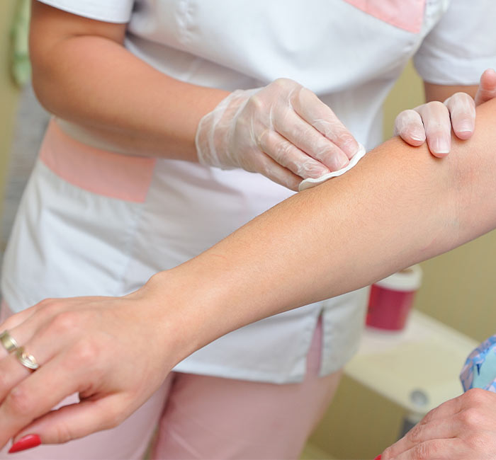 Why Choose Us For Fungal Infection Treatment in Vile Parle